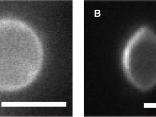 Morphology of vesicle with homeotropic and degenerate planar anchoring before and after deformation when LC is found both inside and outside the membrane.