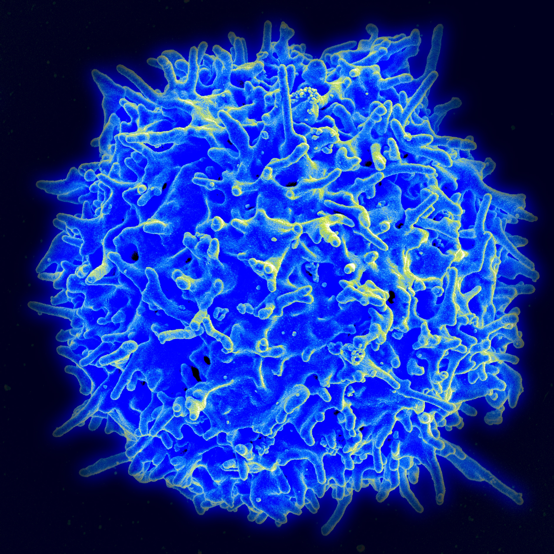A healthy human T-cell. By NIAID/NIH (NIAID Flickr's photostream) [public domain], via Wikimedia Commons.
